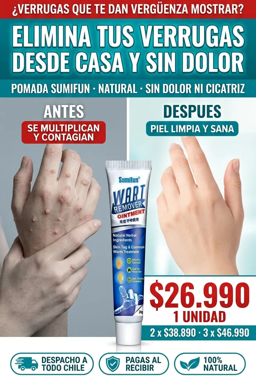 Elimina tus verrugas desde casa y sin dolor
