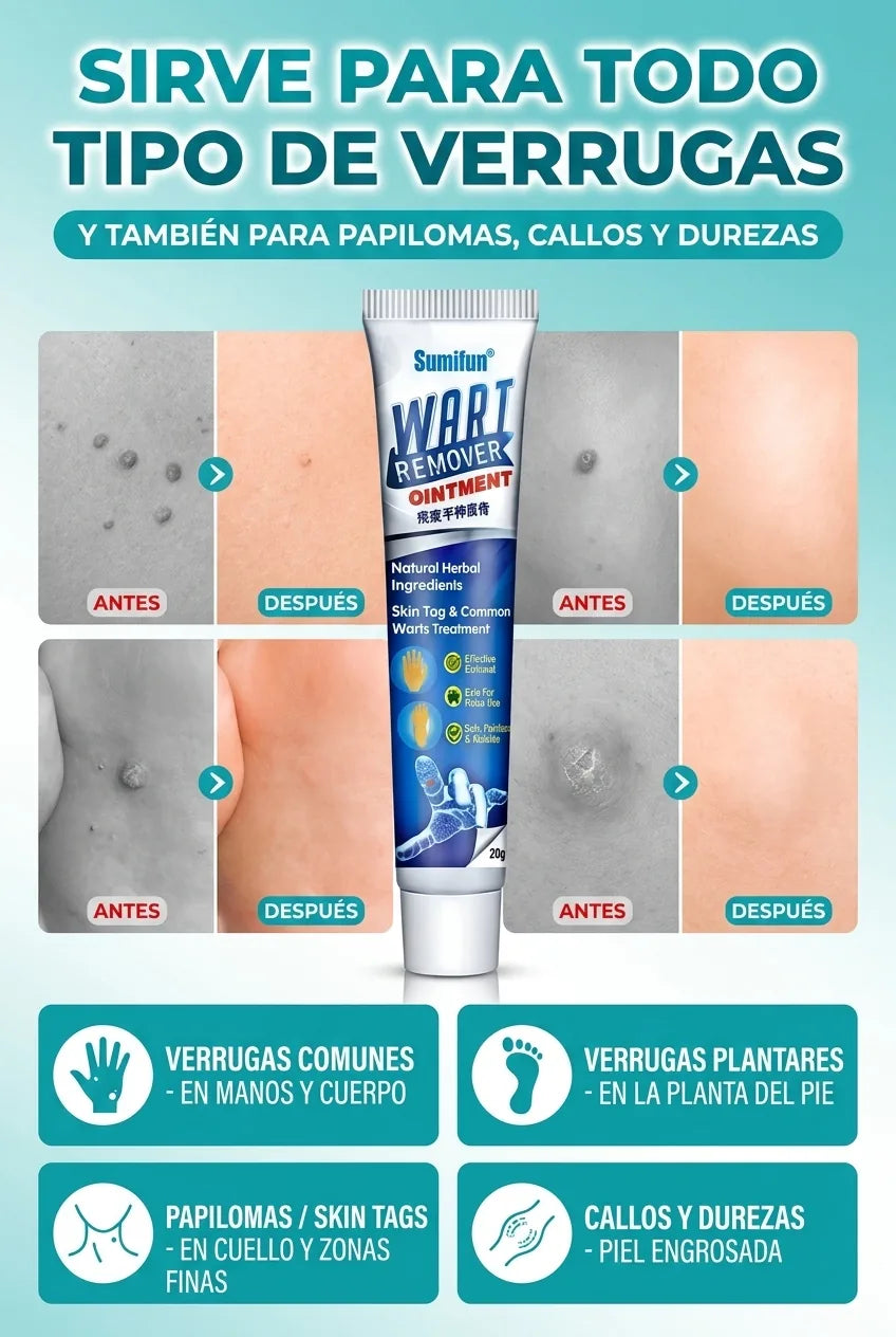 Sirve para todo tipo de verrugas
