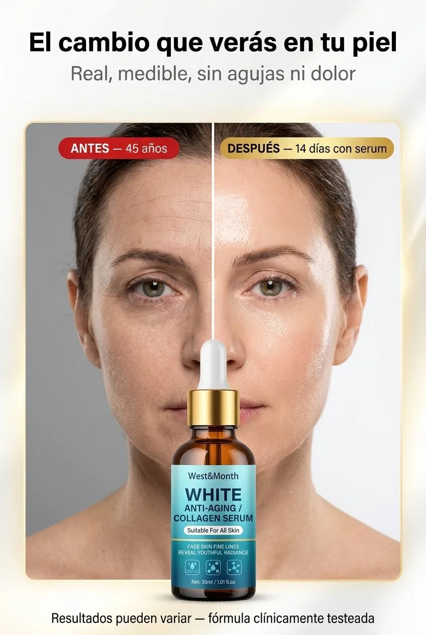Antes y despues — 14 dias con serum